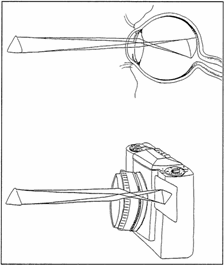 Eye Camera Comparison